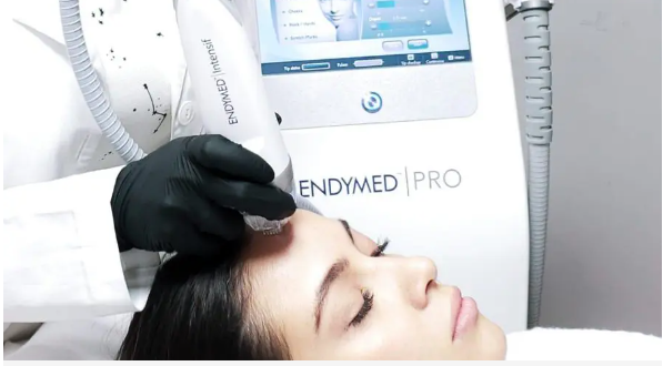 A person getting a skin treatment, Radiofrequency Microneedling